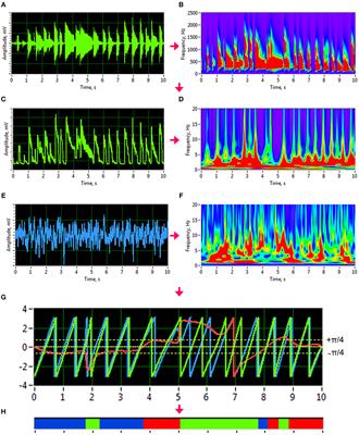 Dynamic Orchestration of Brains and Instruments During Free Guitar Improvisation